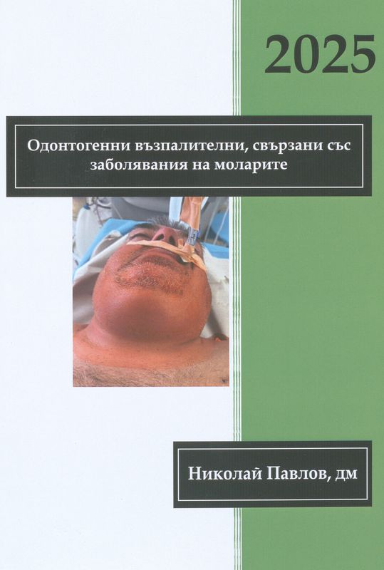 Одонтогенни възпалителни процеси, свързани със заболявания на моларите