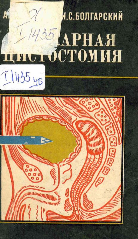 Трокарная цистостомия