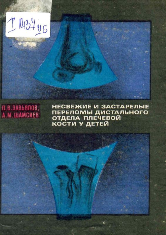 Несвежие и застарелые переломы дистального отдела плечевой кости у детей