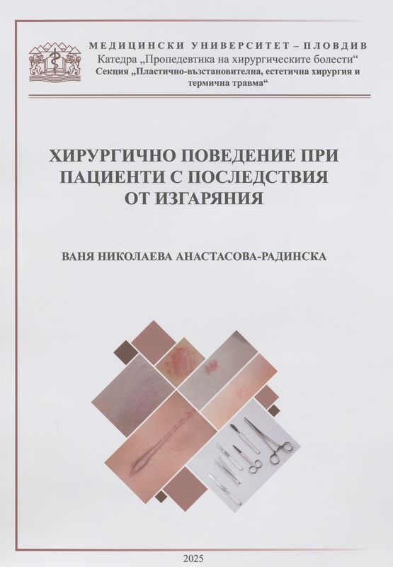Хирургично поведение при пациенти с последствия от изгаряния