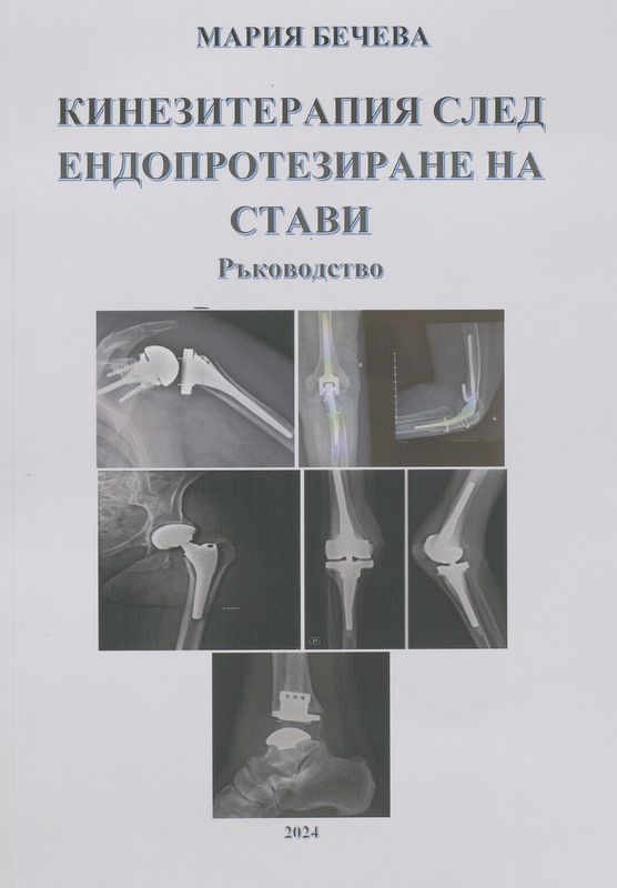 Кинезитерапия след ендопротезиране на стави