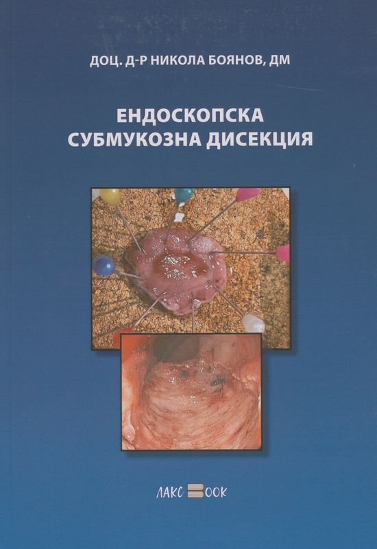 Ендоскопска субмукозна дисекция