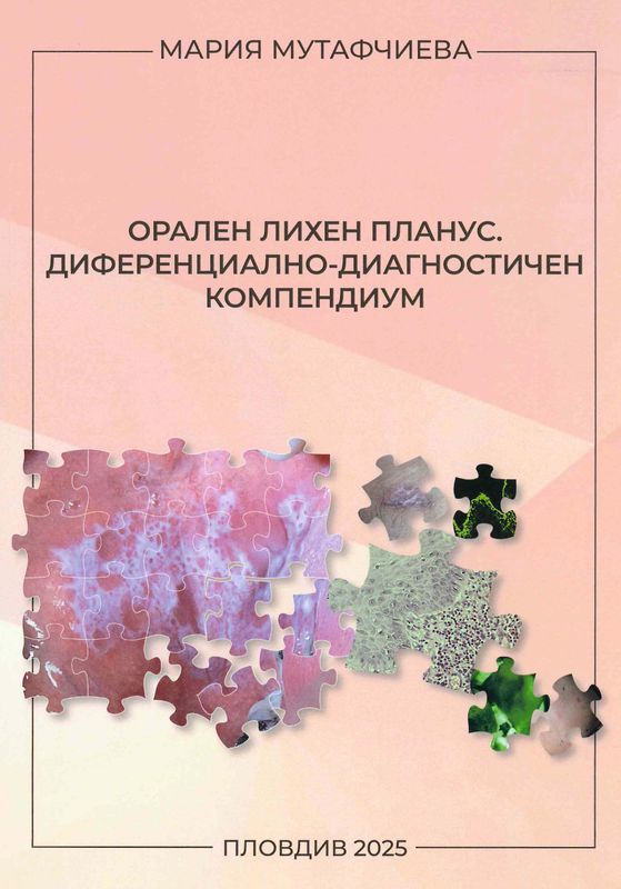 Орален лихен планус. Диференциално-диагностичен компендиум