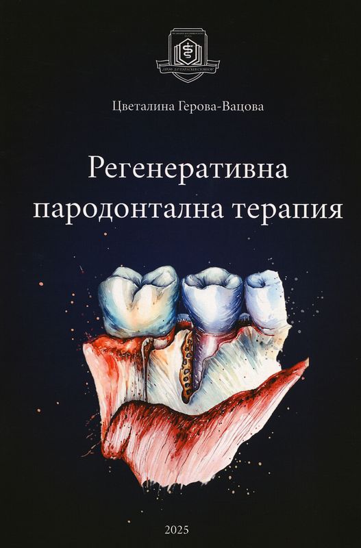 Регенеративна пародонтална терапия